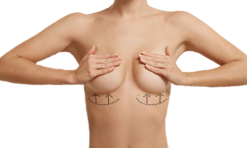 No Visible Scars - Best inverted nipple Surgeon in Mumbai